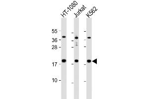 Western Blot at 1:1000 dilution Lane 1: HT-1080 whole cell lysate Lane 2: Jurkat whole cell lysate Lane 3: K562 whole cell lysate Lysates/proteins at 20 ug per lane. (NAA50 抗体  (C-Term))