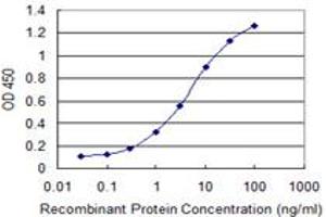 Detection limit for recombinant GST tagged RAB8B is 0. (RAB8B 抗体  (AA 101-207))