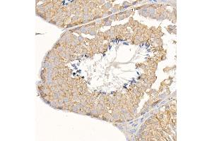 Immunohistochemistry of paraffin-embedded mouse testis using KRAS Rabbit pAb (ABIN3021676, ABIN3021677, ABIN3021678, ABIN1513137 and ABIN1514282) at dilution of 1:150 (40x lens). (K-RAS 抗体)