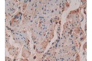 Immunohistochemistry (IHC) image for anti-Vav 3 Oncogene (VAV3) (AA 183-380) antibody (ABIN7437782)