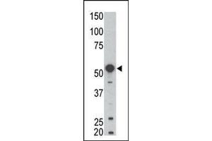 Western blot analysis of anti-BLK Pab (ABIN392087 and ABIN2841844) in mouse kidney tissue lysate. (BLK 抗体  (N-Term))