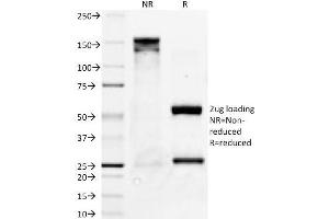 SDS-PAGE Analysis Purified Bcl-x Mouse Monoclonal Antibody (BX006).