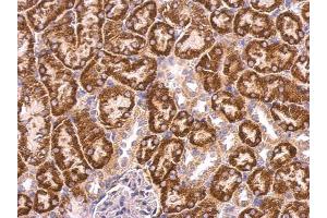 IHC-P Image ABAT antibody detects ABAT protein at mitochondria on mouse kidney by immunohistochemical analysis. (ABAT 抗体)