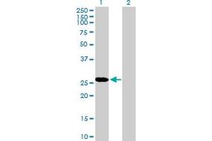 Western Blot analysis of RBPMS expression in transfected 293T cell line by RBPMS MaxPab polyclonal antibody. (RBPMS 抗体  (AA 1-219))
