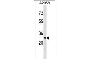 MGLL Antibody (N-term) (ABIN1539310 and ABIN2848550) western blot analysis in  cell line lysates (35 μg/lane). (MGLL 抗体  (N-Term))