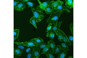 IF analysis of EPLIN/LIMA1 using anti-EPLIN/LIMA1 antibody (ABIN7602639). (LIMA1 抗体  (AA 9-744))