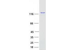 SART3 Protein (Myc-DYKDDDDK Tag)