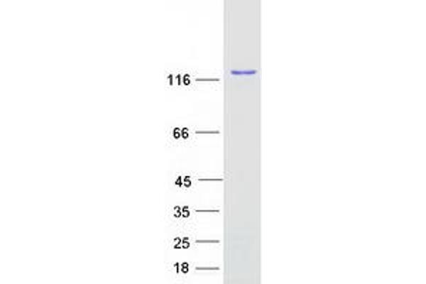 SART3 Protein (Myc-DYKDDDDK Tag)