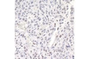 Immunohistochemistry (IHC) image for anti-Zinc Finger E-Box Binding Homeobox 1 (ZEB1) (AA 1074-1124) antibody (ABIN7448887) (ZEB1 抗体  (AA 1074-1124))