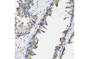 Immunohistochemistry of paraffin-embedded human prostate using OTC antibody at dilution of 1:100 (x40 lens). (OTC 抗体)