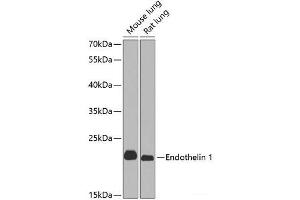 Western blot analysis of extracts of various cell lines using Endothelin 1 Polyclonal Antibody at dilution of 1:1000. (Endothelin 1 抗体)