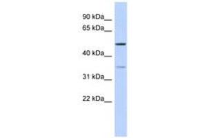 Image no. 1 for anti-Cholesteryl Ester Transfer Protein (CETP) (AA 395-444) antibody (ABIN6743589) (CETP 抗体  (AA 395-444))