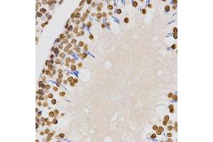 Immunohistochemistry of paraffin-embedded rat testis using DiMethyl-Histone H4-K20 antibody.