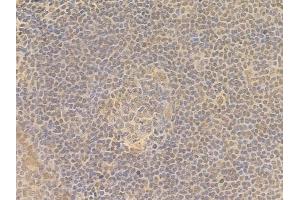 ABIN7095684 and ABIN7099746 at 1/100 staining human normal tonsil tissue by IHC-P. (KLHL26 抗体)