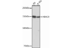 Western blot analysis of extracts of various cell lines, using HD Rabbit mAb (ABIN1680476, ABIN3015870, ABIN3015871 and ABIN7101453) at 1:1000 dilution.