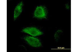 Immunofluorescence of monoclonal antibody to DUSP6 on HeLa cell. (DUSP6 抗体  (AA 1-381))