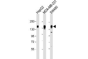 All lanes : Anti-C Antibody (C-term) at 1:2000 dilution Lane 1: HepG2 whole cell lysate Lane 2: MDA-MB-231 whole cell lysate Lane 3: S whole cell lysate Lysates/proteins at 20 μg per lane. (CD130/gp130 抗体  (C-Term))