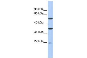MGC34821 antibody used at 1 ug/ml to detect target protein. (MGC34821 (Middle Region) 抗体)