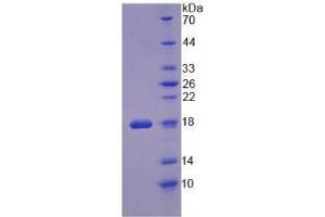 SDS-PAGE analysis of Human Ribonuclease A Protein. (RNASE1 蛋白)