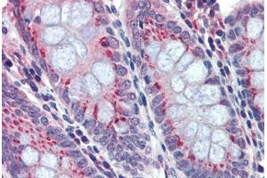 Human Colon: Formalin-Fixed, Paraffin-Embedded (FFPE) (BACE2 抗体  (C-Term))