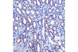 Immunohistochemistry of paraffin-embedded Mouse kidney using LETMD1 Rabbit pAb (ABIN3023040, ABIN3023041, ABIN3023042, ABIN1513151 and ABIN6219360) at dilution of 1:100 (40x lens). (LETMD1 抗体  (AA 161-360))