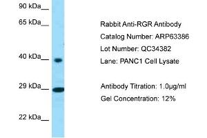 Western Blotting (WB) image for anti-Retinal G Protein Coupled Receptor (RGR) (C-Term) antibody (ABIN971566) (RGR 抗体  (C-Term))