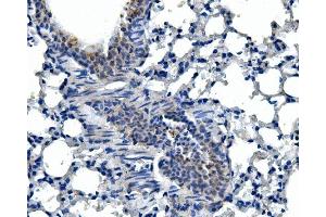 IHC analysis of Adam28 using anti-Adam28 antibody (ABIN7600945).