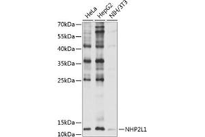 Western blot analysis of extracts of various cell lines, using NHP2L1 antibody (ABIN6132411, ABIN6144624, ABIN6144625 and ABIN6221625) at 1:1000 dilution.