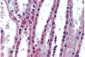 Human Kidney (formalin-fixed, paraffin-embedded) stained with APIP antibody ABIN292116 at 10 ug/ml followed by biotinylated goat anti-rabbit IgG secondary antibody ABIN481713, alkaline phosphatase-streptavidin and chromogen. (APIP 抗体)