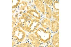 Immunohistochemistry of paraffin-embedded human kidney using PDE4DIP antibody at dilution of 1:100 (40x lens). (PDE4DIP 抗体)