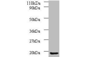 Western blot All lanes: AP1S3 antibody at 2 μg/mL + A549 whole cell lysate Secondary Goat polyclonal to rabbit IgG at 1/10000 dilution Predicted band size: 19, 20, 13 kDa Observed band size: 19 kDa (AP1S3 抗体  (AA 1-104))
