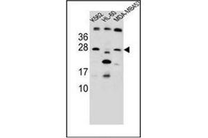 Western blot analysis of DKK4 Antibody (C-term) in K562,HL-60, MDA-MB453 cell line lysates (35ug/lane). (DKK4 抗体  (C-Term))