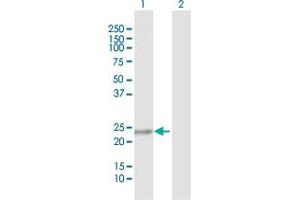 Western Blot analysis of C9orf95 expression in transfected 293T cell line by C9orf95 MaxPab polyclonal antibody. (NMRK1 抗体  (AA 1-199))