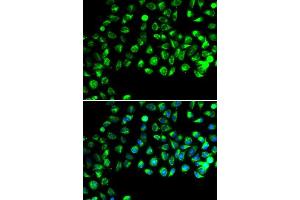 Immunofluorescence analysis of A549 cells using C16orf80 antibody. (C16orf80 抗体  (AA 1-193))