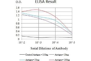Black line: Control Antigen (100 ng),Purple line: Antigen (10 ng), Blue line: Antigen (50 ng), Red line:Antigen (100 ng) (S1PR1 抗体)