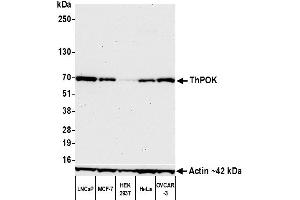 Western Blotting (WB) image for anti-ThPok (AA 250-300) antibody (ABIN7455169) (Recombinant ThPok (AA 250-300) 抗体)