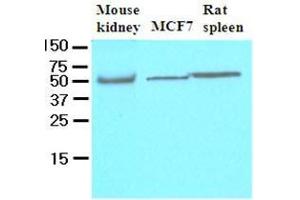 Cell lysates of mouse kidney, MCF7 and rat spleen (40 ug) were resolved by SDS-PAGE, transferred to nitrocellulose membrane and probed with anti-human FLIP (1:500). (FLIP 抗体  (AA 1-376))