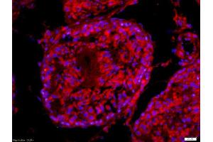 Formalin-fixed and paraffin-embedded rat testis labeled with Anti-PLCZ1 Polyclonal Antibody, Unconjugated (ABIN801183) 1:200, overnight at 4°C, The secondary antibody was Goat Anti-Rabbit IgG,Cy3 conjugated used at 1:200 dilution for 40 minutes at 37°C. (PLCz1 抗体  (AA 351-450))