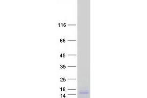 Western Blotting (WB) image for Ribosomal Protein L19 (RPL19) protein (Myc-DYKDDDDK Tag) (ABIN2731132)