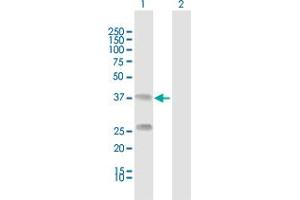 Western Blot analysis of C4BPB expression in transfected 293T cell line by C4BPB MaxPab polyclonal antibody. (C4BPB 抗体  (AA 1-252))