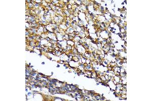 Immunohistochemistry of paraffin-embedded human colon using CD82 Rabbit mAb (ABIN7266222) at dilution of 1:100 (40x lens). (CD82 抗体)