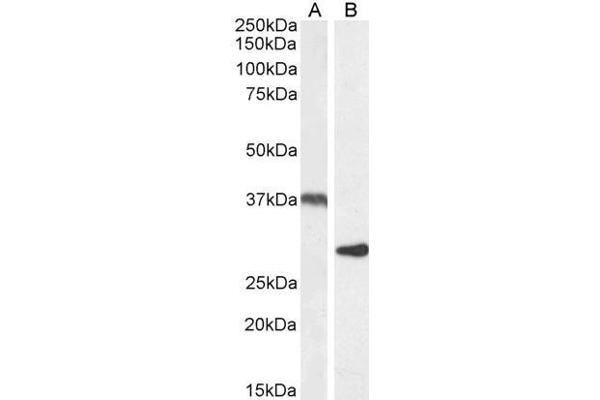 UCP2 抗体  (Internal Region)