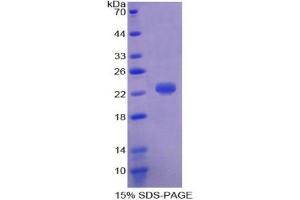 SDS-PAGE (SDS) image for Haptoglobin (HP) ELISA Kit (ABIN6574214)