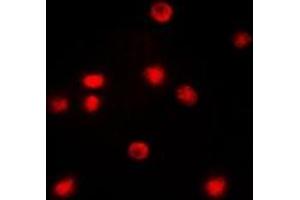 Immunofluorescent analysis of C/EBP zeta staining in COLO205 cells. (DDIT3 抗体  (N-Term))