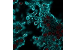 Confocal immunofluorescent analysis of HeLa cells using Pan-Cytokeratin Mouse Monoclonal Antibody (PAN-CK) followed by goat anti-mouse IgG-CF488 (cyan). (KRT 抗体)