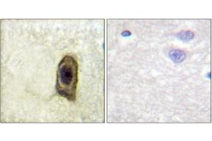 Immunohistochemical analysis of paraffin-embedded human brain, using CSFR (Phospho-Tyr561) antibody (left)or the same antibody preincubated with blocking peptide (right). (CSF1R 抗体  (pTyr561))
