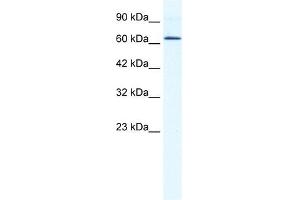 DDX21 antibody used at 1. (DDX21 抗体)