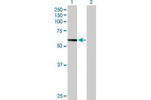 Western Blot analysis of HEXB expression in transfected 293T cell line by HEXB MaxPab polyclonal antibody. (HEXB 抗体  (AA 1-556))