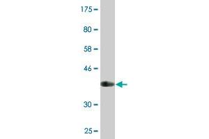 Western Blotting (WB) image for anti-Melanoma Antigen Family A, 12 (MAGEA12) (AA 70-168) antibody (ABIN517711)