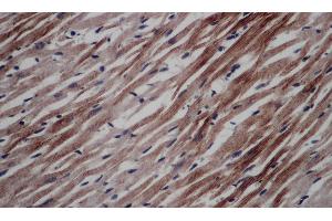 Immunohistochemistry of paraffin-embedded Rat heart using CD297 Polyclonal Antibody at dilution of 1:50 (ART4 抗体)